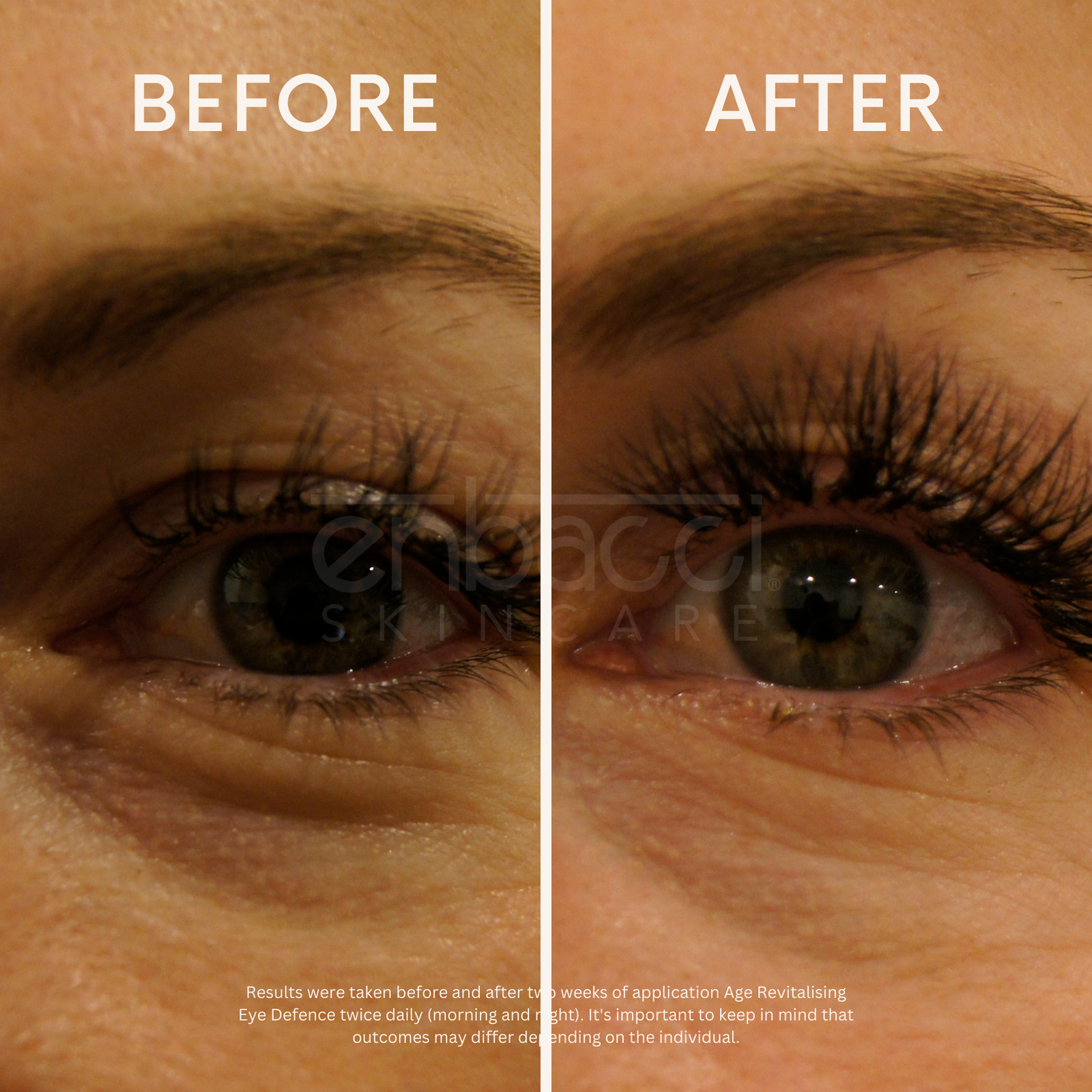 Age Revitalising Eye Defence - Enbacci Skincare