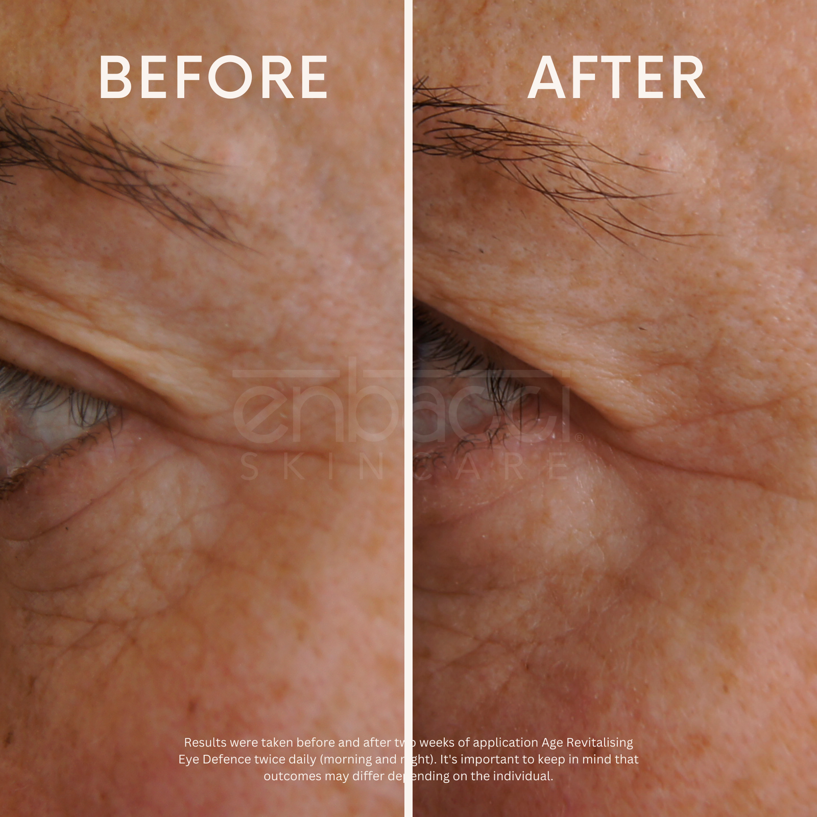Age Revitalising Eye Defence - Enbacci Skincare