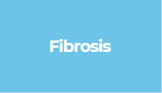 fibrosis is the excess of connective tissue, seen most commonly as scarring